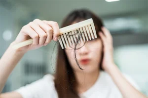 postpartum hair loss